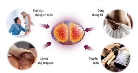 Bệnh lậu và những con đường lây nhiễm chính