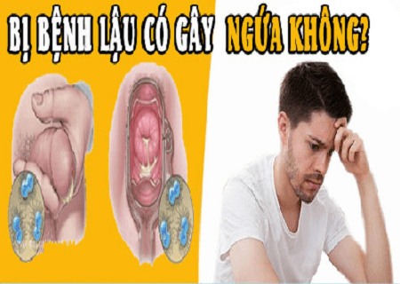 Bệnh lậu có ngứa không ?