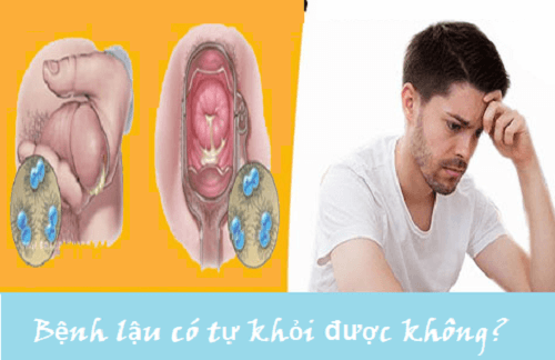 Bệnh lậu có thể tự khỏi không?