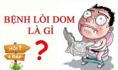 Bệnh lòi dom là hiện tượng trực tràng lòi ra ngoài hậu môn
