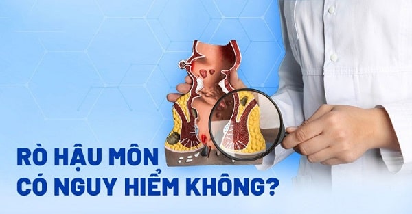Bệnh rò hậu môn có nguy hiểm gì hay không?