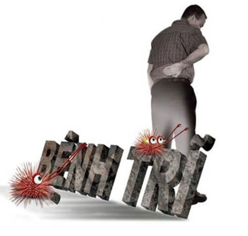 Trĩ là căn bệnh thuộc khu vực hậu môn trực tràng