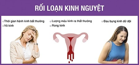 Liệu bạn đã hiểu đúng về rối loạn kinh nguyệt hay chưa ?