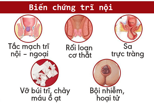 Biến chứng trĩ nội