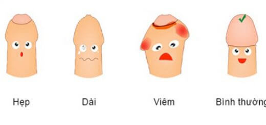 Bệnh về bao quy đầu
