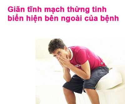 Các triệu chứng giãn tĩnh mạch tinh hoàn thường gặp