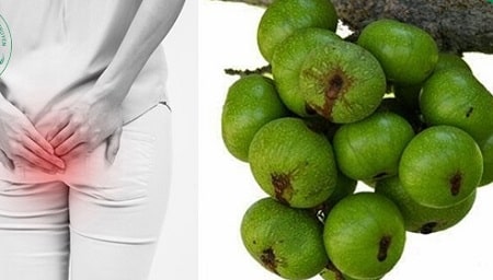 Chữa trĩ ngoại đơn giản bằng quả sung