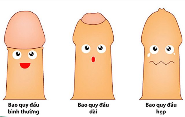 Trường hợp nào nên chữa hẹp bao quy đầu tại nhà?