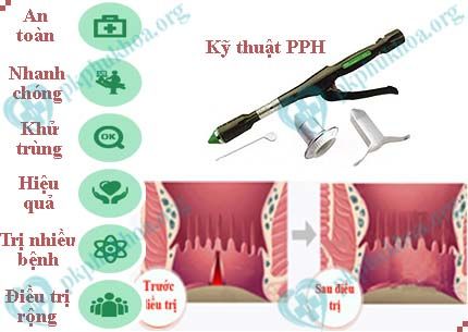 cách điều trị nứt kẽ hậu môn hiệu quả