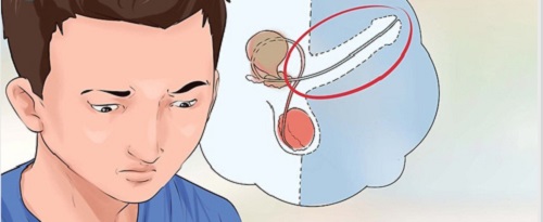 Cách giữ cương lâu