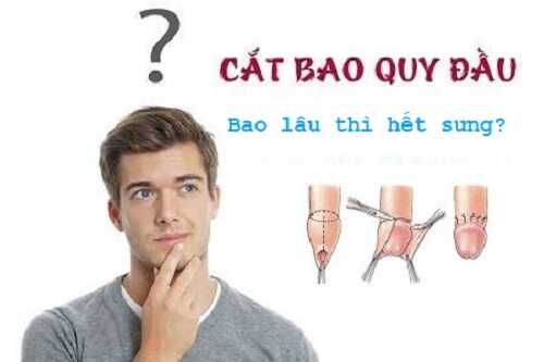 Cắt bao quy đầu mất bao lâu hết sưng? 
