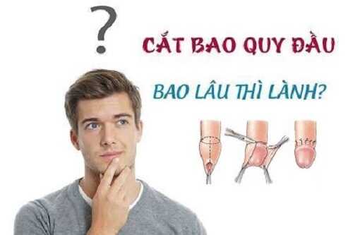 Cắt bao quy đầu mất bao lâu lành tùy thuộc vào phương pháp cắt bao quy đầu 