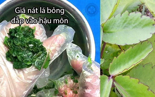 Lá cây bỏng chữa bệnh trĩ bằng cách đắp