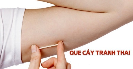 Công dụng của que tránh thai như thế nào?
