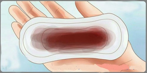 Chậm kinh 10 ngày ra máu nâu
