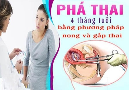 Phá thai 4 tháng tuổi có nên không?