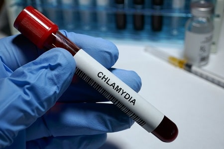 Chlamydia sống được bao lâu nếu can thiệp điều trị?