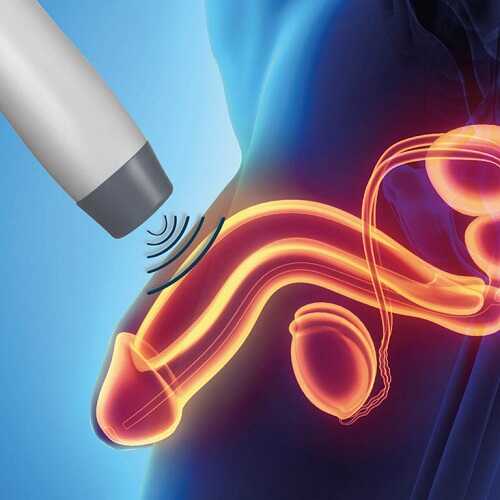 Chi phí chữa xuất tinh sớm bằng sóng cao tần phụ thuộc nhiều vào các yếu tố