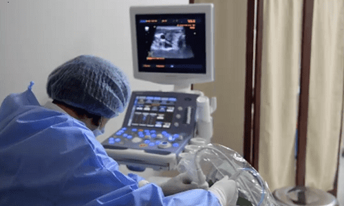 Chữa xuất tinh sớm bằng sóng cao tần