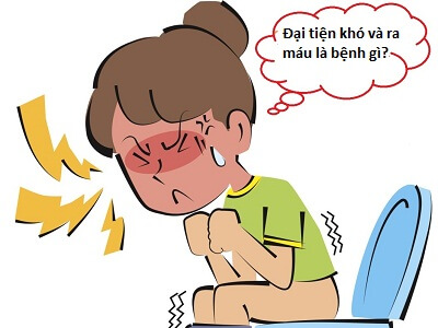 Đại tiện ra máu là nguyên nhân gây bệnh hậu môn