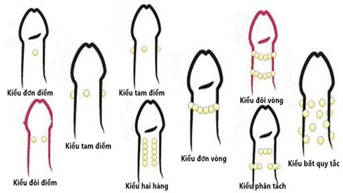 Đâm bi dương vật