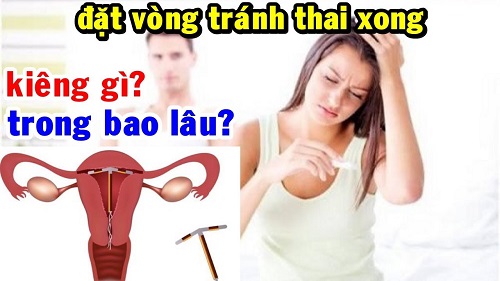 Đặt vòng tránh thai xong cần kiêng những gì?