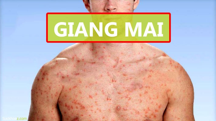 Bệnh giang mai ảnh hưởng nghiêm trọng như thế nào đối với nam giới ?