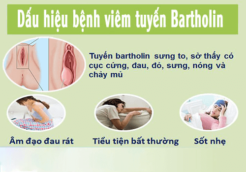 Dấu hiệu bị viêm tuyến bartholin