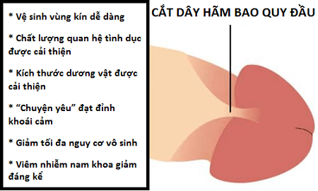 Cắt dây hãm bao quy đầu có tác dụng gì?