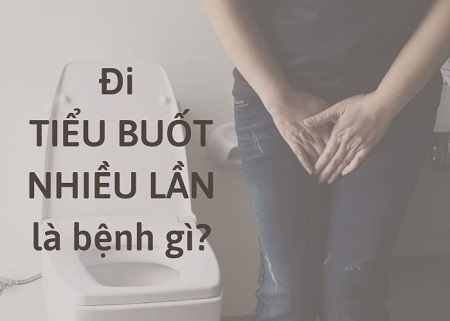 Tiểu nhiều tiểu buốt là bệnh gì và dấu hiệu nhận biết