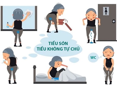 Nguyên nhân gây ra tình trạng đi tiểu són