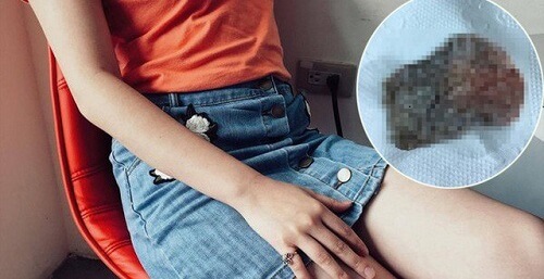Dị vật âm đạo