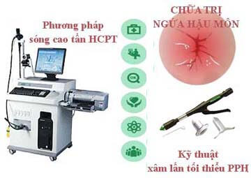 Phương pháp HCPT điều trị ngứa rát hậu môn