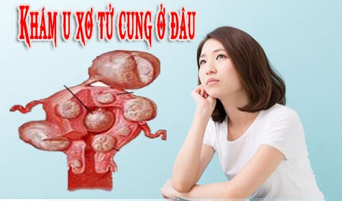 Khám u xơ tử cung ở đâu?