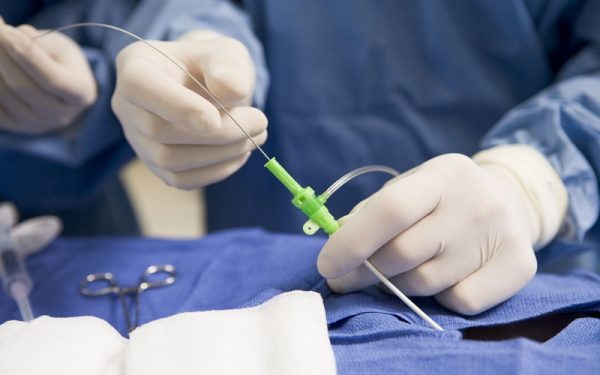 Điều trị viêm lộ tuyến: Sử dụng đông tây y kết hợp sóng cao tần