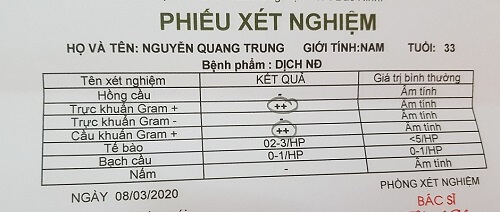 Kết quả xét nghiệm dịch niệu đạo (Hình ảnh minh họa)