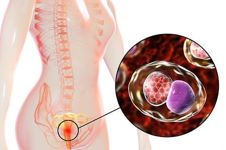 Tìm hiểu đường lây của Chlamydia