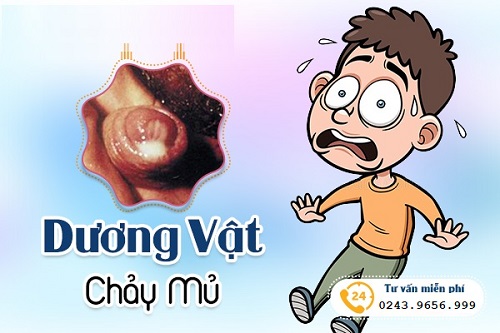 Dương vật chảy mủ