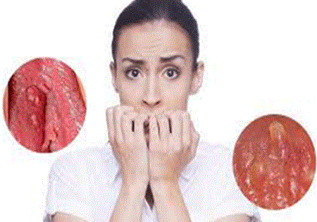 Gai sinh dục nữ có nguy hiểm không?