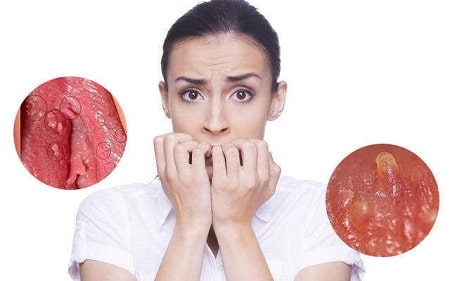 Gai sinh dục thường mọc ở đâu ?