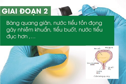Giai đoạn 2