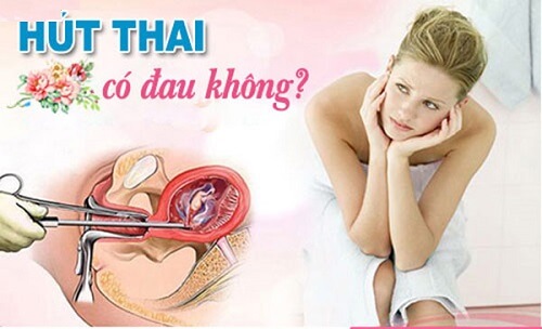 Hút thai có đau không?