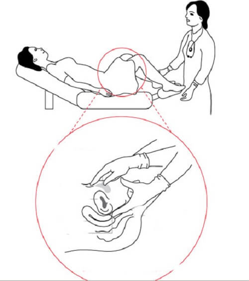 Khám phụ khoa bằng tay không đau
