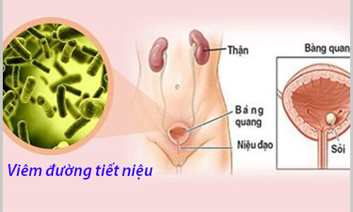 Khám chữa viêm đường tiết niệu ở đâu Hà Nội?