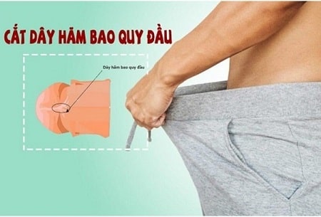 Một vài vấn đề cần lưu ý khi thực hiện khâu dây hãm bao quy đầu