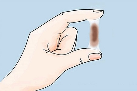 Các phương pháp điều trị khí hư có màu nâu đỏ 
