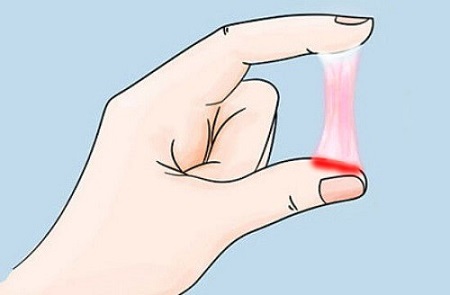 Hiện tượng ra khí hư có máu là gì?
