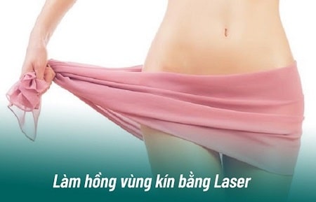 Có nên làm hồng cô bé bằng laser không?