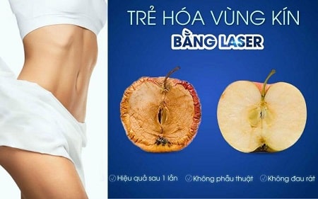 Quy trình làm hồng cô bé bằng laser