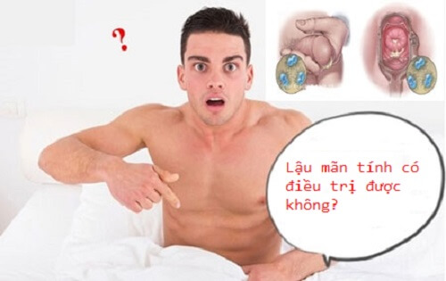 Lậu mãn tính có điều trị được không?